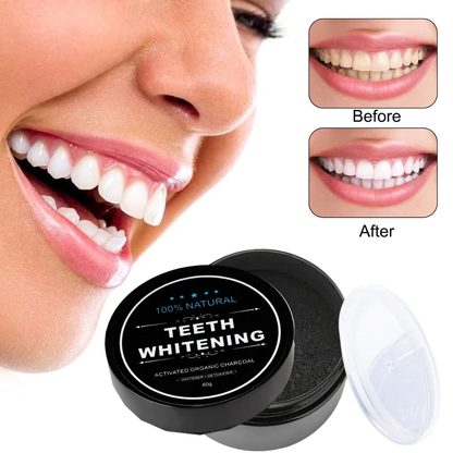 TeethWhitening ✨| Blanqueador de dientes con Carbon Activado